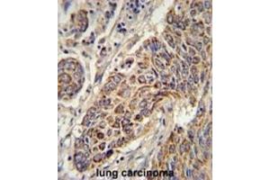 Immunohistochemistry (IHC) image for anti-Cytochrome C1 (CYC1) antibody (ABIN3002307) (Cytochrome C1 antibody)