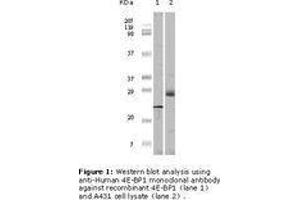 Image no. 1 for anti-Eukaryotic Translation Initiation Factor 4E Binding Protein 1 (EIF4EBP1) antibody (ABIN207630) (eIF4EBP1 antibody)