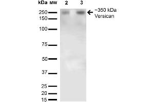 Western Blot analysis of Rat Brain Membrane and brain showing detection of 350kDa Versican protein using Mouse Anti-Versican Monoclonal Antibody, Clone S351-23 . (Versican antibody  (AA 362-585) (PerCP))