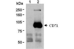 Western Blotting (WB) image for anti-Transferrin Receptor (p90, CD71) (TFRC) antibody (ABIN1449271) (Transferrin Receptor antibody)