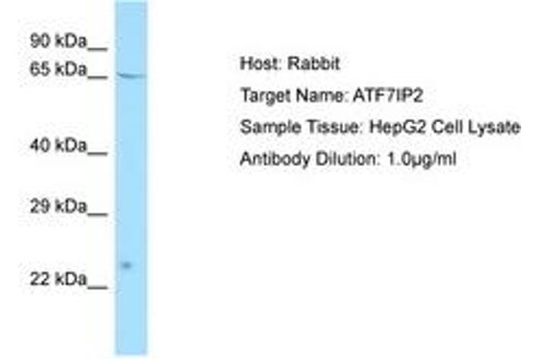 ATF7IP2 antibody  (AA 100-149)