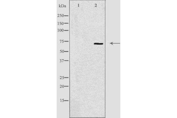 HIPK4 antibody  (C-Term)