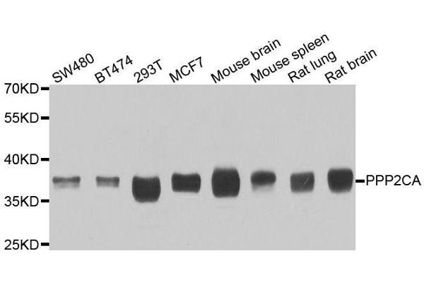 PPP2CA antibody  (AA 1-309)