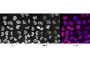 Detection of H3K37ac by immunofluorescence U2OS cells were stained with H3K37ac antibody at a dilution of 1:500. (Histone 3 antibody  (acLys37))
