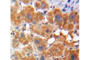 IHC-P analysis of Liver tissue, with DAB staining. (Apolipoprotein F antibody  (AA 111-314))