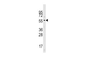 Western blot analysis of Cdc25A Pab (ABIN390213 and ABIN2840695) in mouse kidney tissue lysates (35 μg/lane). (CDC25A antibody  (N-Term))