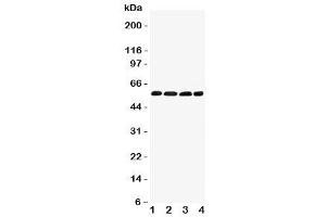 Western blot testing of IRF5 antibody and Lane 1:  human placenta (IRF5 antibody  (C-Term))