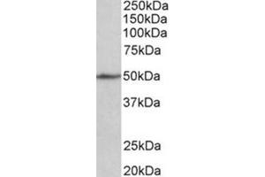 AP31781PU-N CADM1 antibody staining of Mouse Fetal Heart lysate at 1 µg/ml (35 µg protein in RIPA buffer). (CADM1 antibody  (Internal Region))