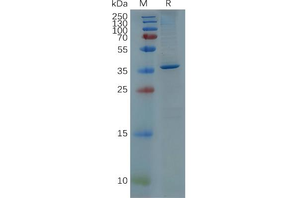 GFAP Protein (AA 68-377) (His tag)