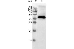 Western blot of MNPs (CCR8 Protein)