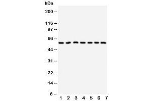 Western blot testing of CYP11B1 antibody and Lane 1:  HeLa (CYP11B1 antibody  (C-Term))