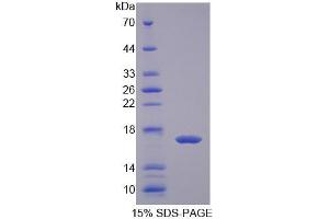 SDS-PAGE (SDS) image for Fatty Acid Binding Protein 2, Intestinal (FABP2) (AA 2-128) protein (His tag) (ABIN4988463) (FABP2 Protein (AA 2-128) (His tag))