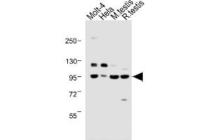 Western Blotting (WB) image for anti-BRCA1 Associated Protein-1 (Ubiquitin Carboxy-terminal Hydrolase) (BAP1) (AA 36-66) antibody (ABIN388948)