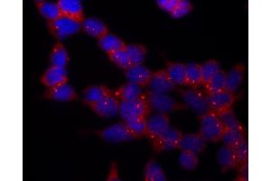 Immunocytochemistry (ICC) image for anti-Tubulin, gamma 1 (TUBG1) (C-Term) antibody (ABIN94313)