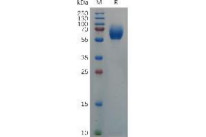 Cynomolgus IL18BP Protein, hFc Tag on SDS-PAGE under reducing condition. (IL18BP Protein (AA 28-207) (Fc Tag))