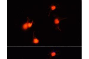 Immunofluorescence analysis of U-251MG cells using BDNF Polyclonal Antibody at dilution of 1:100 (40x lens). (BDNF antibody)