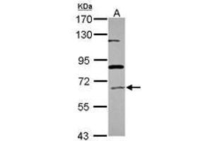 Image no. 1 for anti-Acyl-CoA Oxidase 1, Palmitoyl (ACOX1) (Internal Region) antibody (ABIN1495970) (ACOX1 antibody  (Internal Region))