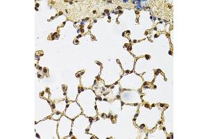 Immunohistochemistry of paraffin-embedded mouse lung using IFI16 Antibody (ABIN6291165) at dilution of 1:100 (40x lens). (IFI16 antibody)