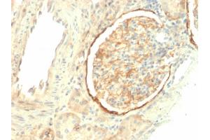 Formalin-fixed, paraffin-embedded human Kidney stained with CD61 Mouse Monoclonal Antibody (ITGB3/2145). (Integrin beta 3 antibody  (AA 385-490))