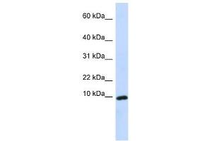 Western Blot showing CXCL9 antibody used at a concentration of 1-2 ug/ml to detect its target protein. (CXCL9 antibody  (Middle Region))