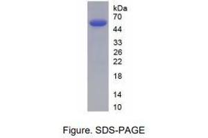 SDS-Page (IgE Protein (AA 1-429) (His tag))