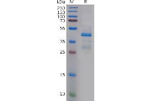 Human PTN Protein, His Tag on SDS-PAGE under reducing condition. (Pleiotrophin Protein (PTN) (AA 33-168) (Fc Tag))
