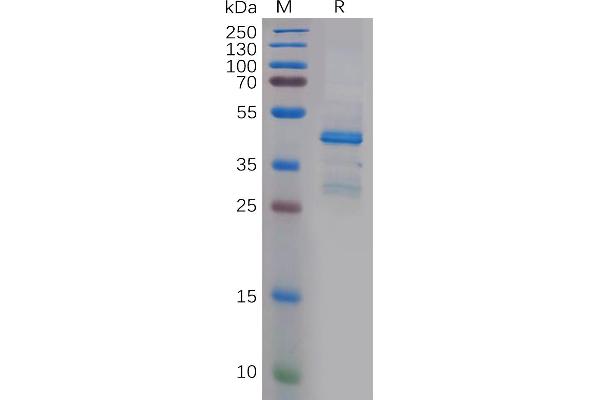 Pleiotrophin Protein (PTN) (AA 33-168) (Fc Tag)