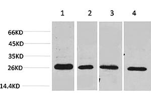 Western blot analysis of 1) MCF7, 2) Mouse Heart tissue, 3) Rat Heart tissue, 4) rat brain tissue using SLUG Polyclonal Antibody. (SLUG antibody)