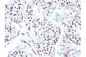 Immunohistochemistry (Formalin-fixed Paraffin-embedded Sections) (IHC (fp)) image for anti-Histone antibody (ABIN3024807)