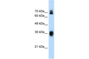 Western Blotting (WB) image for anti-Kelch-Like ECH-Associated Protein 1 (KEAP1) antibody (ABIN2461037) (KEAP1 antibody)