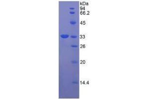 SDS-PAGE analysis of Human RORg Protein. (RORC Protein)