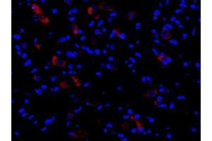 Immunofluorescence (Paraffin-embedded Sections) (IF (p)) image for anti-NLR Family, Pyrin Domain Containing 3 (NLRP3) (AA 15-120) antibody (ABIN1386361)