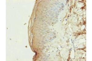 Immunohistochemistry of paraffin-embedded human skin tissue using ABIN7163341 at dilution of 1:100 (Phospholipase D4 antibody  (AA 52-506))