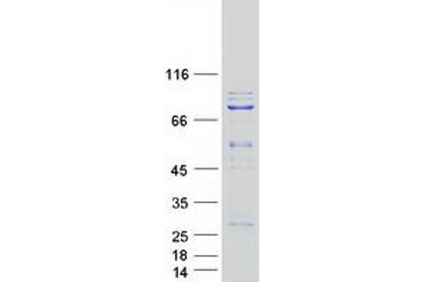 KLHL22 Protein (Myc-DYKDDDDK Tag)