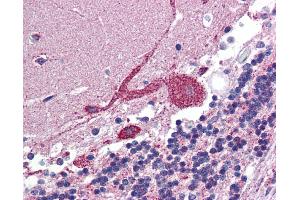 IHC Information: Paraffin embedded brain, cerebellum tissue, tested with an antibody dilution of 5 ug/ml. (ARF6 antibody  (Middle Region))