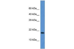 WB Suggested Anti-Fxn Antibody Titration: 1. (Frataxin antibody  (C-Term))