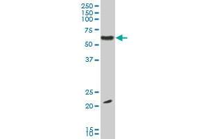 EBF3 monoclonal antibody (M06), clone 1G3. (EBF3 antibody  (AA 381-480))