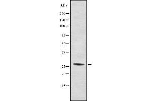 Western blot analysis of PSMA5 using RAW264. (PSMA5 antibody  (N-Term))