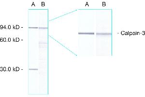 Western Blot: analysis of human skeletal muscle showing detection of calpain 3 proteins. (Calpain antibody  (AA 1-19))