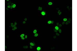 Immunofluorescent analysis of HepG2 cells using ABIN7139587 at dilution of 1:100 and Alexa Fluor 488-congugated AffiniPure Goat Anti-Rabbit IgG(H+L) (Histone H1-Like (LOC107807853) (meLys11) antibody)