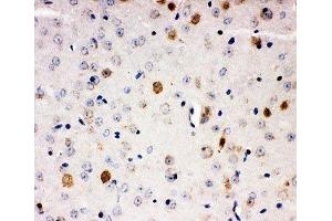 IHC-P: AHR antibody testing of mouse brain tissue (Aryl Hydrocarbon Receptor antibody  (C-Term))