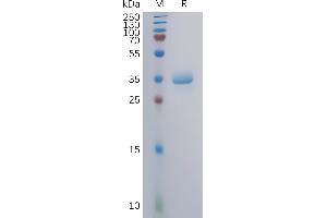 Human GA Protein, mFc Tag on SDS-PAGE under reducing condition. (GPRC5A Protein (AA 1-33) (mFc Tag))