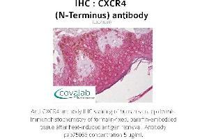 Image no. 1 for anti-Chemokine (C-X-C Motif) Receptor 4 (CXCR4) antibody (ABIN1733408) (CXCR4 antibody)