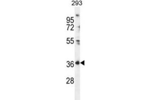 Western Blotting (WB) image for anti-Folate Receptor 4 (Delta) (FOLR4) antibody (ABIN2996480) (Folate Receptor 4 antibody)