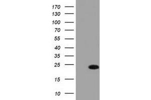 Western Blotting (WB) image for anti-Fas (TNFRSF6)-Associated Via Death Domain (FADD) antibody (ABIN1498178) (FADD antibody)