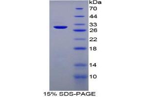 SDS-PAGE analysis of Rat Heparin Cofactor II Protein. (SERPIND1 Protein)