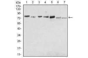 Western blot analysis using SDC1 mouse mAb against MCF-7 (1), Hela (2), HepG2 (3), T47D (4), SW620 (5), Jurkat (6) and NIH/3T3 (7) cell lysate. (Syndecan 1 antibody  (AA 28-171))