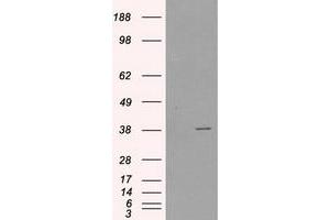 HEK293T cells were transfected with the pCMV6-ENTRY control (Left lane) or pCMV6-ENTRY SORD (Right lane) cDNA for 48 hrs and lysed. (SORD antibody)