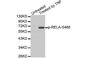 Western Blotting (WB) image for anti-Nuclear Factor-kB p65 (NFkBP65) (pSer468) antibody (ABIN1870585) (NF-kB p65 antibody  (pSer468))