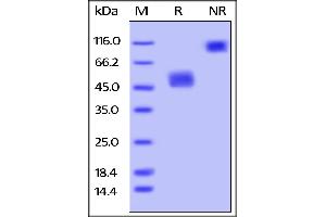 Biotinylated Mouse BAFFR /TNFRSF13C, Fc Tag, Avi Tag (Avitag™) on SDS-PAGE under reducing (R) and no-reducing (NR) conditions. (TNFRSF13C Protein (AA 10-71) (Fc Tag,AVI tag,Biotin))